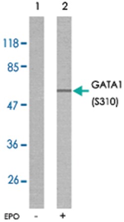 GATA1 (phospho S310), Rabbit anti-Human, Mouse, Rat, Polyclonal Antibody, Abnova 100 &mu;g | Buy Online | Abnova Corporation | Fisher Scientific