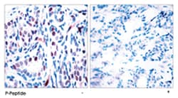 STAT3 (phospho Y705), Rabbit anti-Human, Mouse, Rat, Polyclonal Antibody, Abnova 100 &mu;g | Buy Online | Abnova Corporation | Fisher Scientific