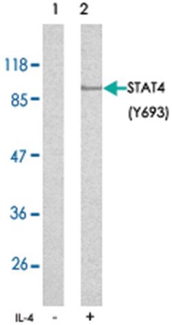 STAT4 (phospho Y693), Rabbit anti-Human, Mouse, Rat, Polyclonal Antibody,