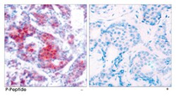 STAT4 (phospho Y693), Rabbit anti-Human, Mouse, Rat, Polyclonal Antibody,