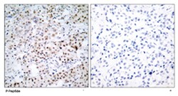 CREB1 (phospho S133), Rabbit anti-Human, Mouse, Rat, Polyclonal Antibody, Abnova 100 &mu;g | Buy Online | Abnova Corporation | Fisher Scientific
