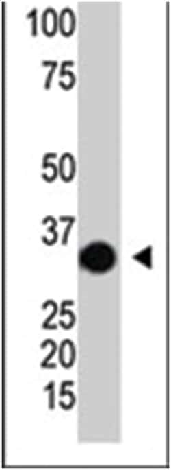 SULT2A1, Rabbit, Polyclonal Antibody, Abnova 400&mu;L; Unlabeled:Antibodies,