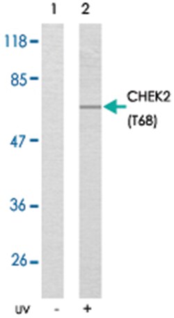 CHEK2 (phospho T68), Rabbit anti-Human, Mouse, Rat, Polyclonal Antibody,