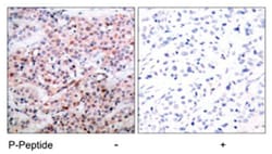 BCL2 (phospho T56), Rabbit anti-Human, Polyclonal Antibody, Abnova 100&mu;g;