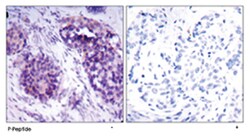 BCL2L1 (phospho S62), Rabbit anti-Human, Mouse, Rat, Polyclonal Antibody, Abnova 100 &mu;g | Buy Online | Abnova Corporation | Fisher Scientific