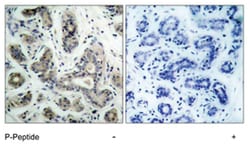 BAD (phospho S136), Rabbit anti-Human, Mouse, Rat, Polyclonal Antibody, Abnova 100 &mu;g | Buy Online | Abnova Corporation | Fisher Scientific