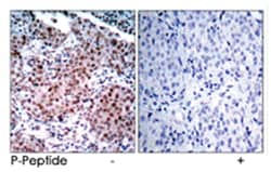 ESR1 (phospho S104), Rabbit anti-Human, Mouse, Polyclonal Antibody, Abnova