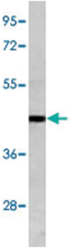 SULT2B1, Rabbit, Polyclonal Antibody, Abnova 400 &mu;L | Buy Online | Abnova Corporation | Fisher Scientific