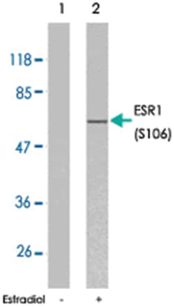 ESR1 (phospho S106), Rabbit anti-Human, Mouse, Polyclonal Antibody, Abnova 100 &mu;g | Buy Online | Abnova Corporation | Fisher Scientific