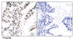 ESR1 (phospho S106), Rabbit anti-Human, Mouse, Polyclonal Antibody, Abnova 100 &mu;g | Buy Online | Abnova Corporation | Fisher Scientific