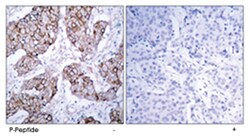 EGFR (phospho Y1092), Rabbit anti-Human, Mouse, Rat, Polyclonal Antibody, Abnova 100 &mu;g | Buy Online | Abnova | Fisher Scientific