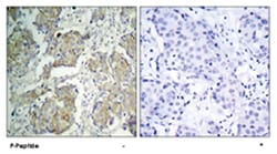 KDR (phospho Y1214), Rabbit anti-Human, Mouse, Rat, Polyclonal Antibody, Abnova 100 &mu;g | Buy Online | Abnova Corporation | Fisher Scientific