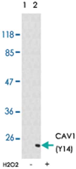 CAV1 (phospho Y14), Rabbit anti-Human, Mouse, Rat, Polyclonal Antibody, Abnova 100 &mu;g | Buy Online | Abnova Corporation | Fisher Scientific