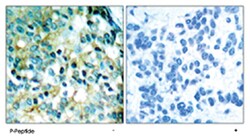 SRC (phospho Y418), Rabbit anti-Human, Mouse, Rat, Polyclonal Antibody, Abnova 100 &mu;g | Buy Online | Abnova Corporation | Fisher Scientific