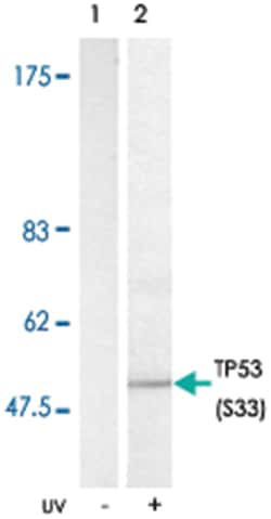 TP53 (phospho S33), Rabbit anti-Human, Polyclonal Antibody, Abnova 100 &mu;g | Buy Online | Abnova Corporation | Fisher Scientific
