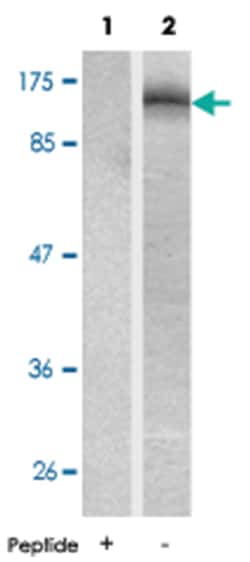 AR (phospho S213), Rabbit anti-Human, Polyclonal Antibody, Abnova 100 &mu;g | Buy Online | Abnova Corporation | Fisher Scientific