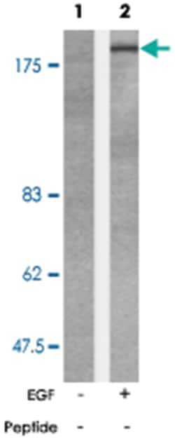 BCR (phospho Y177), Rabbit anti-Human, Mouse, Polyclonal Antibody, Abnova