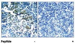 BCR (phospho Y177), Rabbit anti-Human, Mouse, Polyclonal Antibody, Abnova