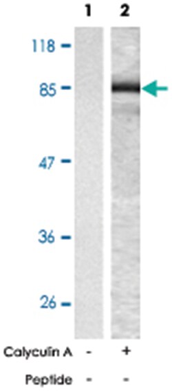 CTNNB1 (phospho S33), Rabbit anti-Human, Mouse, Rat, Polyclonal Antibody,
