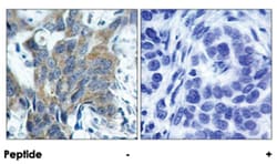 CTNNB1 (phospho S33), Rabbit anti-Human, Mouse, Rat, Polyclonal Antibody,