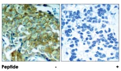 EGFR (phospho Y1172), Rabbit anti-Human, Mouse, Rat, Polyclonal Antibody,