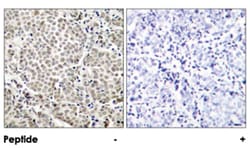 PTK2B (phospho Y402), Rabbit anti-Human, Mouse, Rat, Polyclonal Antibody, Abnova 100 &mu;g | Buy Online | Abnova Corporation | Fisher Scientific