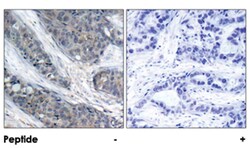 IRS1 (phospho S307), Rabbit anti-Human, Mouse, Rat, Polyclonal Antibody, Abnova 100 &mu;g | Buy Online | Abnova Corporation | Fisher Scientific