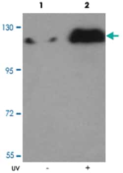 JAK1, Rabbit, Polyclonal Antibody, Abnova 100 &mu;g | Buy Online | Abnova Corporation | Fisher Scientific