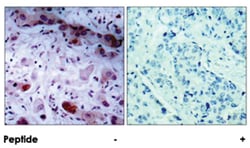 JAK1, Rabbit, Polyclonal Antibody, Abnova 100 &mu;g | Buy Online | Abnova Corporation | Fisher Scientific