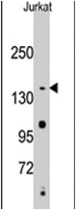 SMC2, Rabbit, Polyclonal Antibody, Abnova 400&mu;L; Unlabeled:Antibodies,