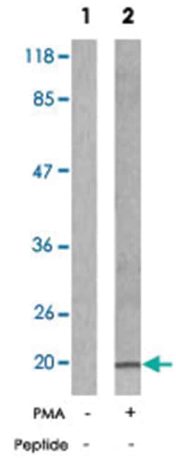 STMN1 (phospho S37), Rabbit anti-Human, Mouse, Rat, Polyclonal Antibody,