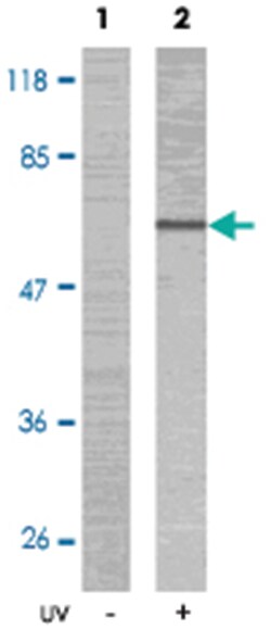 LIMK2 (phospho T505), Rabbit anti-Human, Mouse, Rat, Polyclonal Antibody, Abnova 100 &mu;g | Buy Online | Abnova | Fisher Scientific