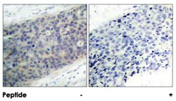 LIMK2 (phospho T505), Rabbit anti-Human, Mouse, Rat, Polyclonal Antibody, Abnova 100 &mu;g | Buy Online | Abnova | Fisher Scientific