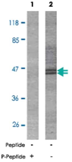 MAPT (phospho S404), Rabbit anti-Human, Mouse, Rat, Polyclonal Antibody, Abnova 100 &mu;g | Buy Online | Abnova Corporation | Fisher Scientific