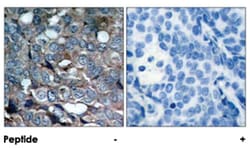 MAP3K5 (phospho S83), Rabbit anti-Human, Polyclonal Antibody, Abnova 100 &mu;g | Buy Online | Abnova Corporation | Fisher Scientific