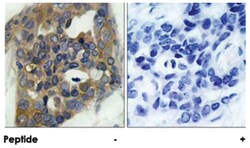 MAP3K5 (phospho S966), Rabbit anti-Human, Mouse, Polyclonal Antibody, Abnova 100 &mu;g | Buy Online | Abnova | Fisher Scientific