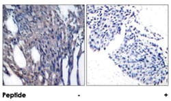 NFKBIA (phospho Y42), Rabbit anti-Human, Mouse, Rat, Polyclonal Antibody, Abnova 100 &mu;g | Buy Online | Abnova Corporation | Fisher Scientific