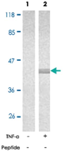 NFKBIE (phospho S22), Rabbit anti-Human, Mouse, Polyclonal Antibody, Abnova 100 &mu;g | Buy Online | Abnova | Fisher Scientific