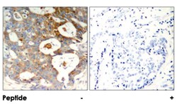 NFKBIE (phospho S22), Rabbit anti-Human, Mouse, Polyclonal Antibody, Abnova 100 &mu;g | Buy Online | Abnova | Fisher Scientific