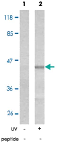 MAP2K1 (phospho S221), Rabbit anti-Human, Mouse, Rat, Polyclonal Antibody, Abnova 100 &mu;g | Buy Online | Abnova Corporation | Fisher Scientific