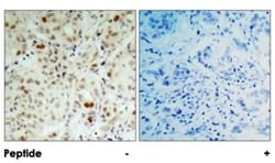 RB1 (phospho S807), Rabbit anti-Human, Mouse, Rat, Polyclonal Antibody,