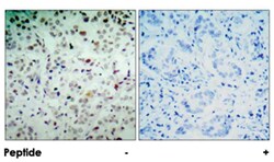 RB1 (phospho S780), Rabbit anti-Human, Mouse, Rat, Polyclonal Antibody,