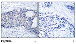ZAP70 (phospho Y493), Rabbit anti-Human, Mouse, Rat, Polyclonal Antibody, Abnova 100 &mu;g | Buy Online | Abnova Corporation | Fisher Scientific