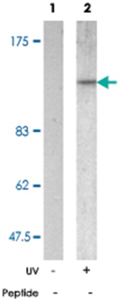 SMC1A (phospho S957), Rabbit anti-Human, Mouse, Polyclonal Antibody, Abnova 100 &mu;g | Buy Online | Abnova | Fisher Scientific