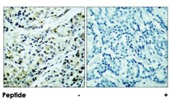 HDAC5 (phospho S498), Rabbit anti-Human, Mouse, Rat, Polyclonal Antibody,