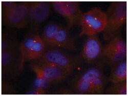 SYT2, Rabbit, Polyclonal Antibody, Abnova 100&mu;g; Unlabeled:Antibodies,