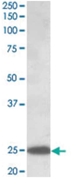 ABHD14B, Goat, Polyclonal Antibody, Abnova 100&mu;g; Unlabeled:Antibodies,
