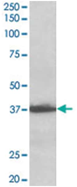 SCYE1 Goat anti-Human, Polyclonal Antibody, Abnova 100 &mu;g | Buy Online | Abnova Corporation | Fisher Scientific