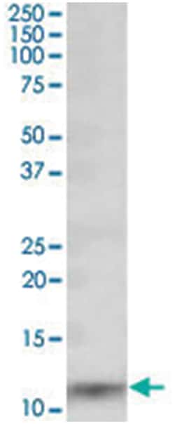 S100A8, Goat, Polyclonal Antibody, Abnova 100 &mu;g | Buy Online | Abnova | Fisher Scientific
