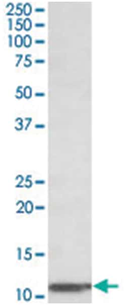 B2M Goat anti-Human, Polyclonal Antibody, Abnova 100&mu;g; Unlabeled:Antibodies,